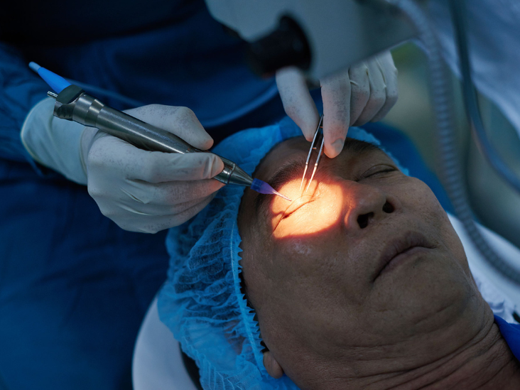Strabismus Surgery