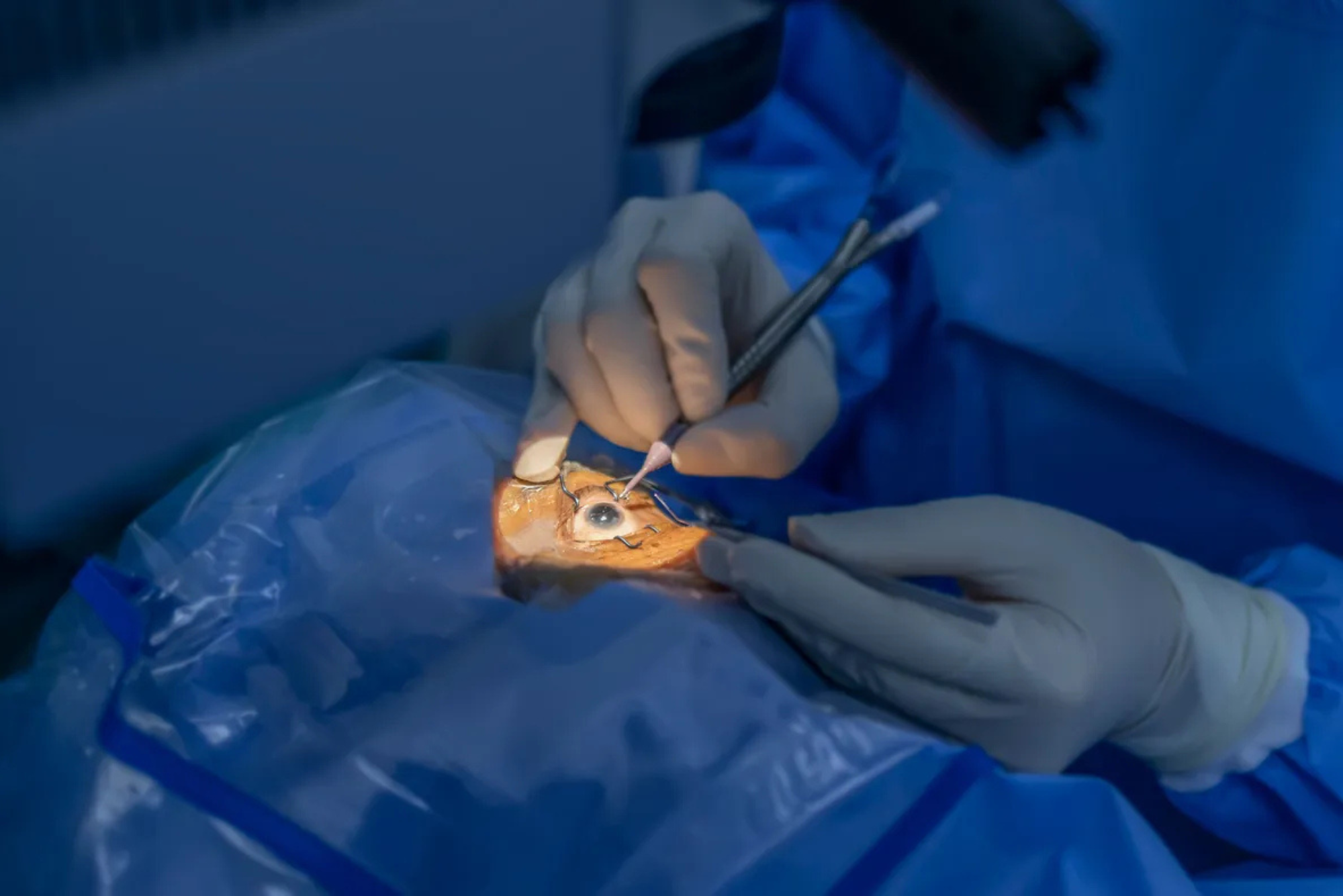 ophthalmologist surgery – ophthalmologist training center ophthalmologist surgery - ophthalmologist training center